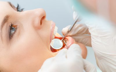 Caries: una afección bucal que se puede prevenir